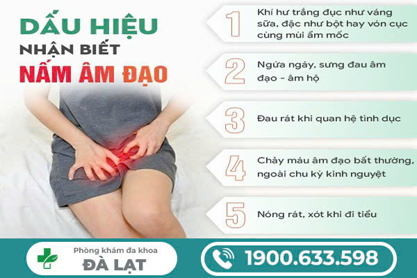 Hình ảnh minh họa